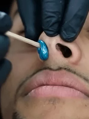 Depilação nariz